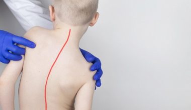 Skolyoz Tedavisinde Doğru Sanılan 7 Yanlışa Dikkat!