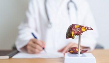 Siroza Bağlı Komplikasyonların Önlenmesi İçin Düzenli Kontroller ve Tedavinin Takibi Önemli! Siroza Bağlı Komplikasyonların Önlenmesi İçin Düzenli Kontroller ve Tedavinin Takibi Önemli!