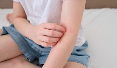 Çocuklarda 'Alerjik Hastalıklar' Hakkında Doğru Sanılan 8 Hatalı Bilgi!