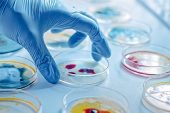 Enfeksiyonun En Ağır Hali: Sepsis