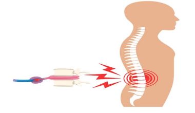 Bel fıtığı ameliyatından sonra tekrarlar mı? Nedenleri, Riskleri ve Tedavi Yaklaşımları