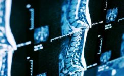 Omurga Sağlığının 5 Büyük Düşmanı: Bel Fıtığı Neden Oluşur?